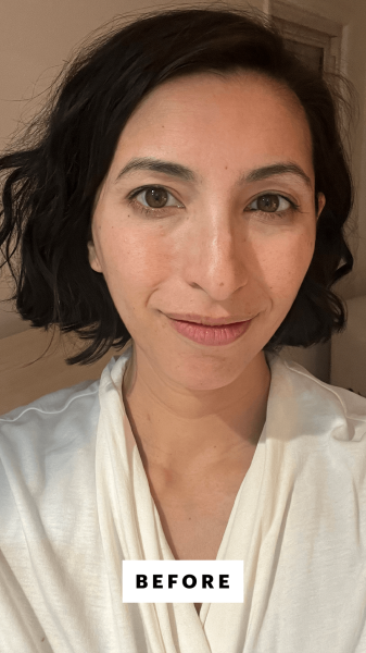 Pai before applying the Naturium Mandelic Topical Acid 12