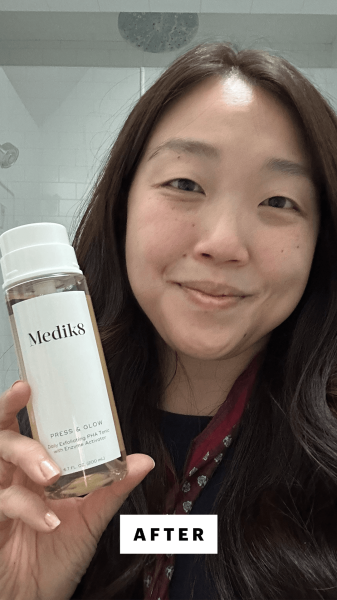 Lee after applying the Medik8 Press and Glow Toner