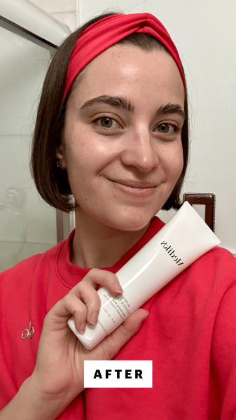 Felbin after applying the Medik8 Surface Radiance Cleanse